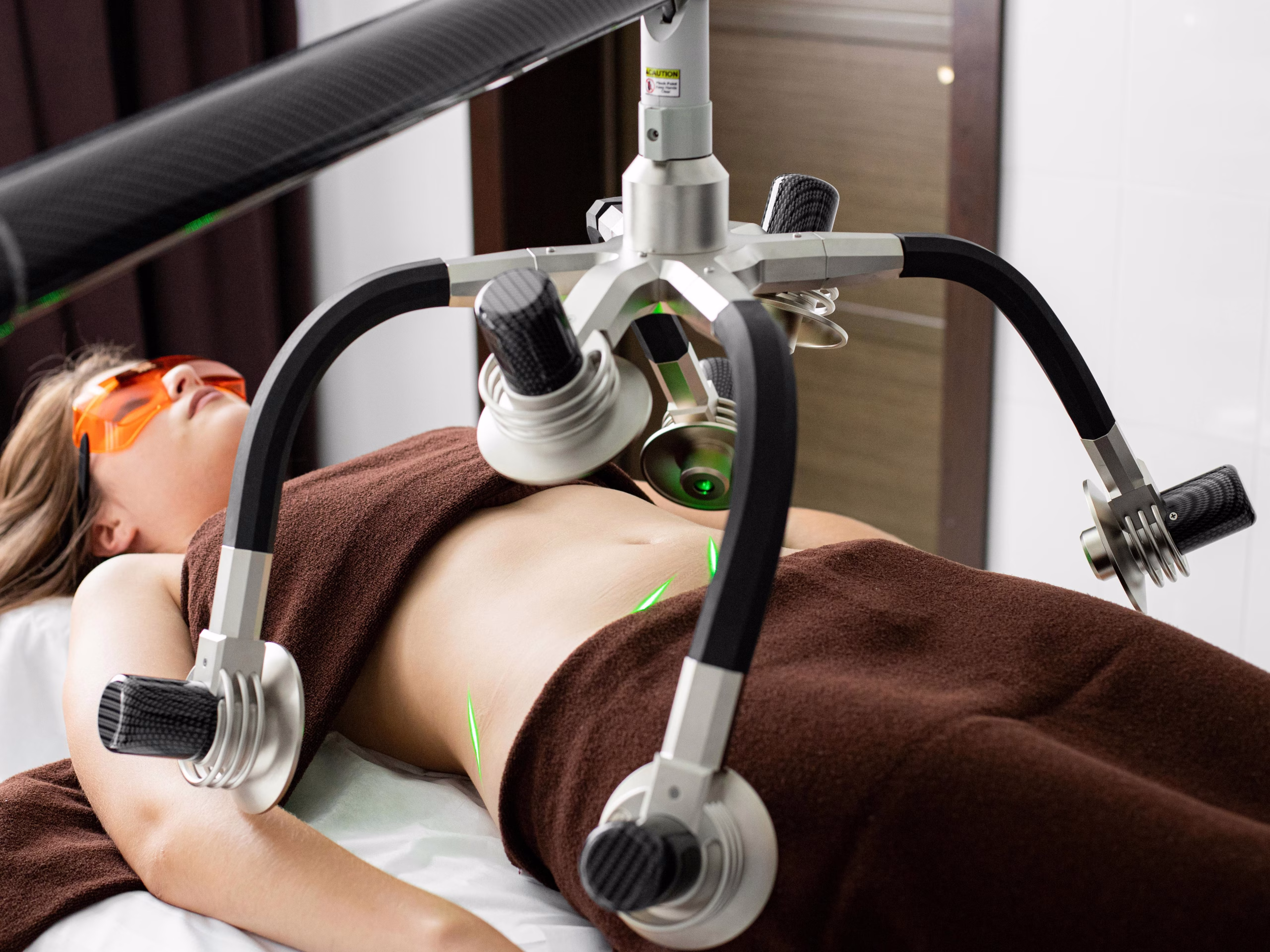 laser skin treatment